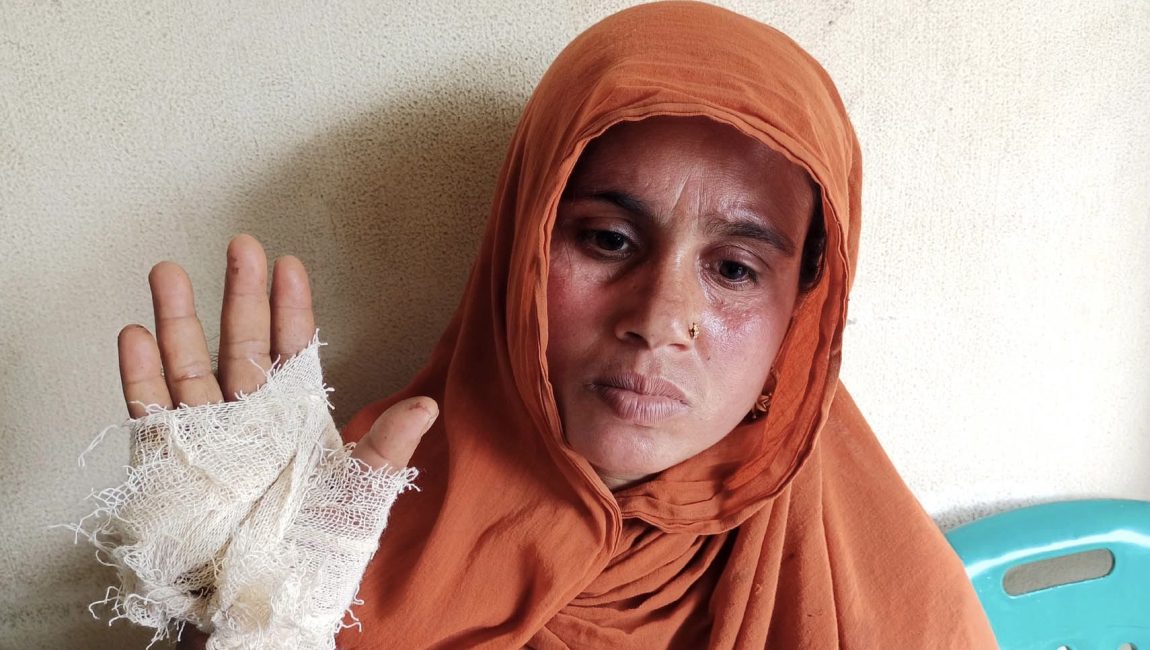 ধুনটে কাস্তের আঘাতে আহত ভাবি। ছবি: এনসিএন