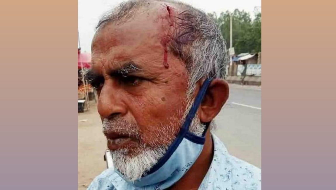 পূর্ব শত্রুতার জেরে সাংবাদিককে মারপিট। ছবি: এনসিএন