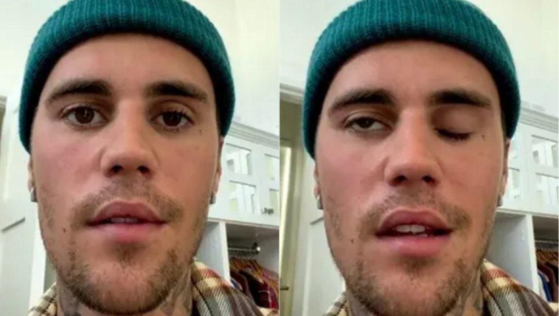 প্যারালাইসিসে আক্রান্ত জাস্টিন বিবার